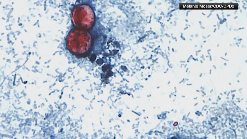 File photo, cyclospora, KEYC News Now